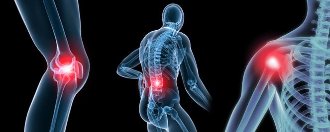 Artróza, nebo-li osteoartróza, jak zmírnit bolest